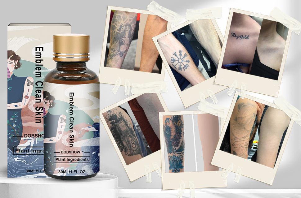 Dobshow™ Tattoo Removal Cream: Quick, Painless, and Scar-Free Tattoo Fading 🌿