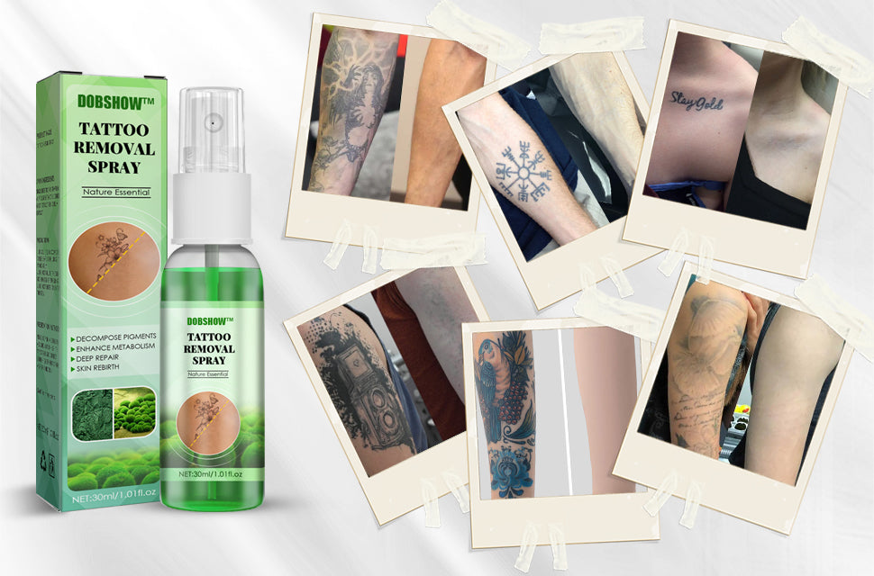 Dobshow™ Tattoo Removal Cream: Fast, Painless & Scar-Free Tattoo Erasure