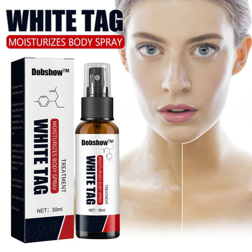 🌿 Herbal Vitiligo Relief Spray 🎉: Nature's Touch for Even Skin Tone ✨