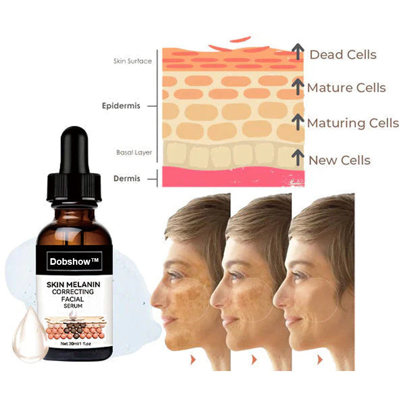 ✨Fast Dark Spot Remover-Dobshow™ Melanin Correcting Facial Serum