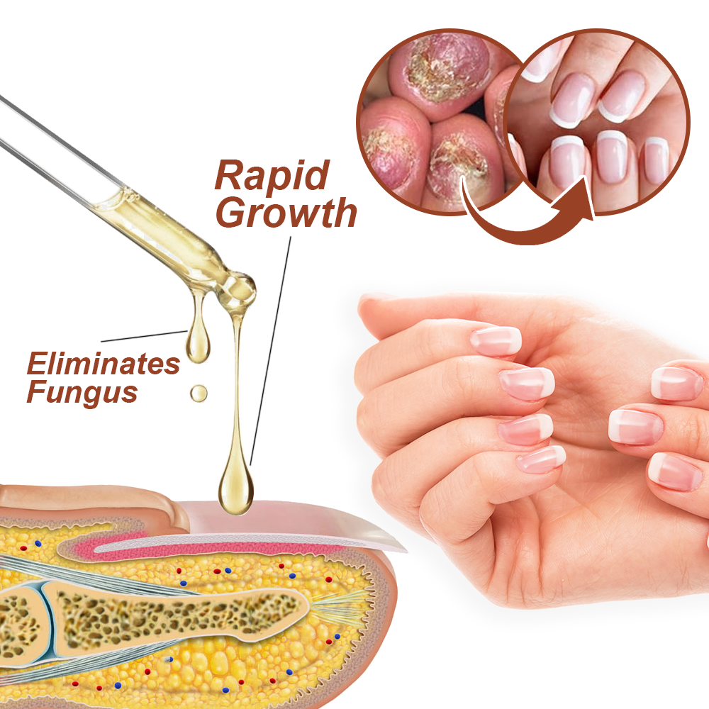 Dobshow™ 7 Days Growth and Strengthening Nail Serum💅🌱💪