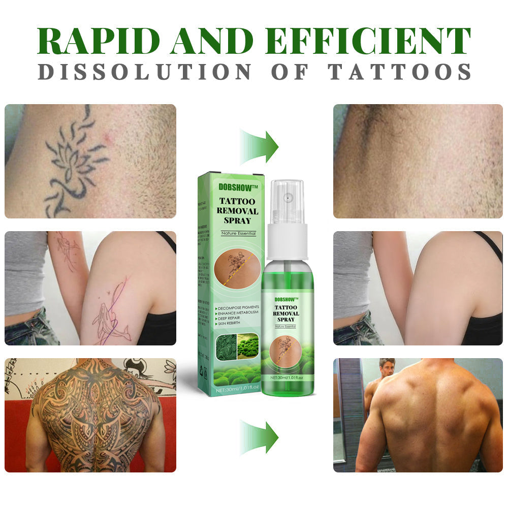 Dobshow™ Tattoo Removal Cream: Fast, Painless & Scar-Free Tattoo Erasure