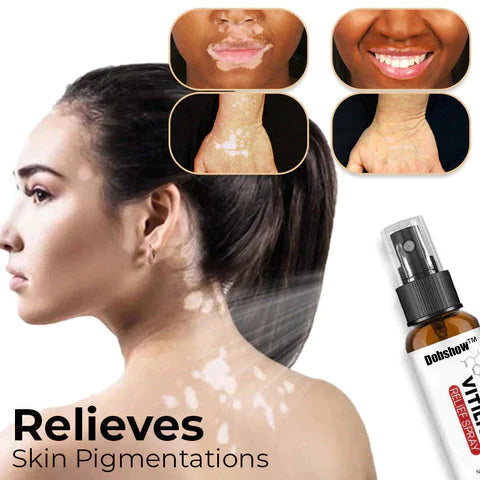 🌿 Herbal Vitiligo Relief Spray 🎉: Nature's Touch for Even Skin Tone ✨