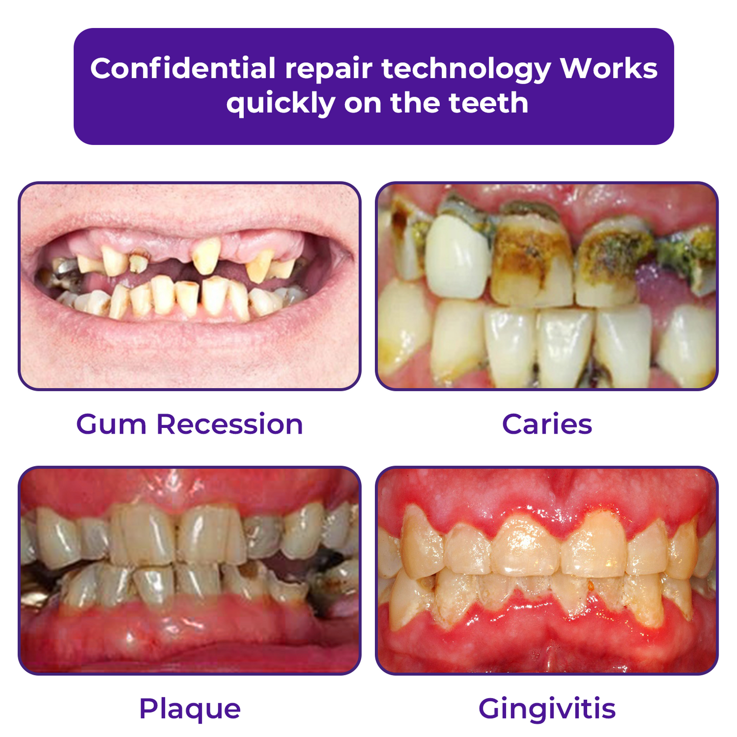 š¦·DobshowĀ® Dental Repair Mineral Powder >> š„Buy 1 Get 1 Freeš„