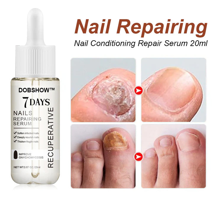 Dobshow™ 7 Days Growth and Strengthening Nail Serum💅🌱💪