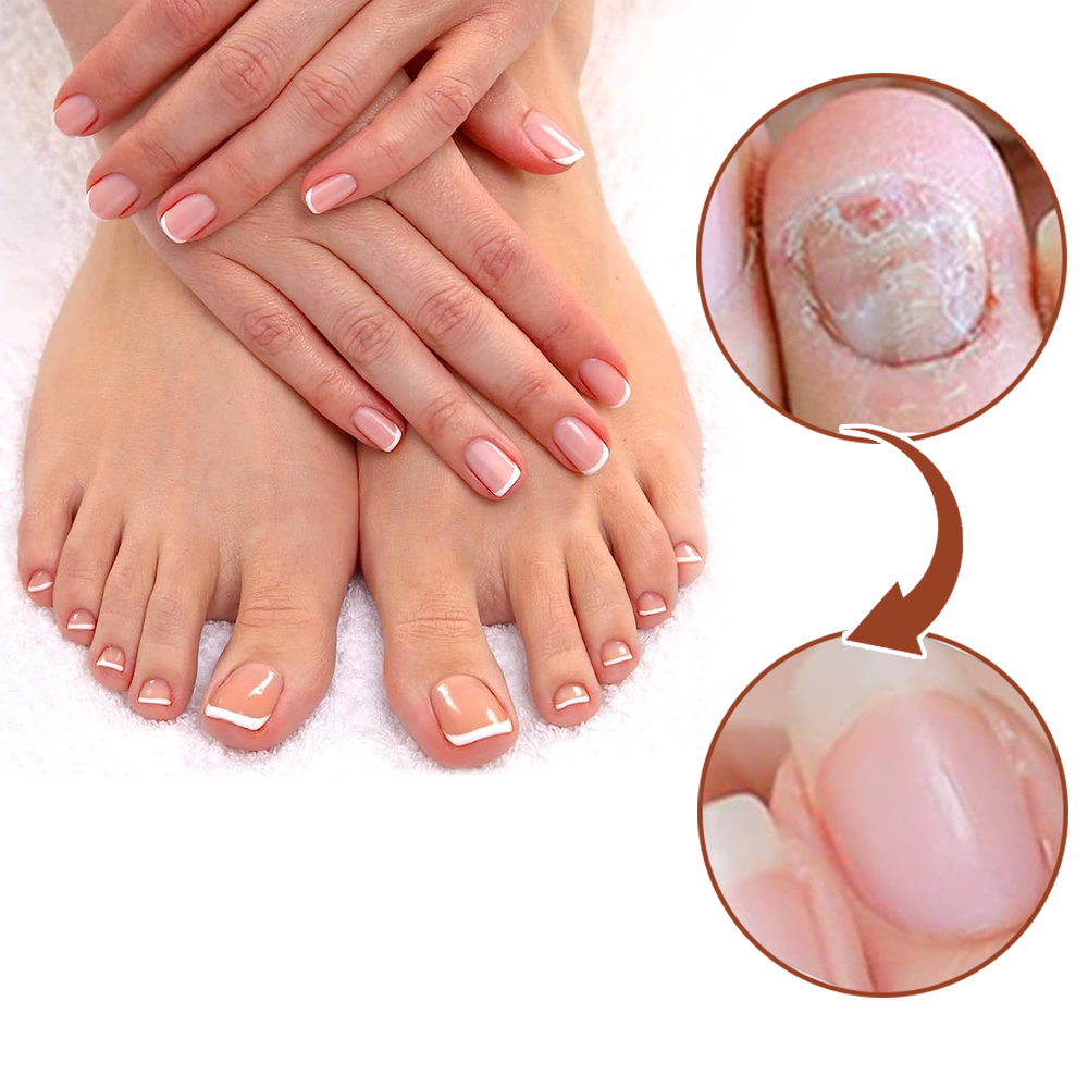 Dobshow™ 7 Days Growth and Strengthening Nail Serum💅🌱💪