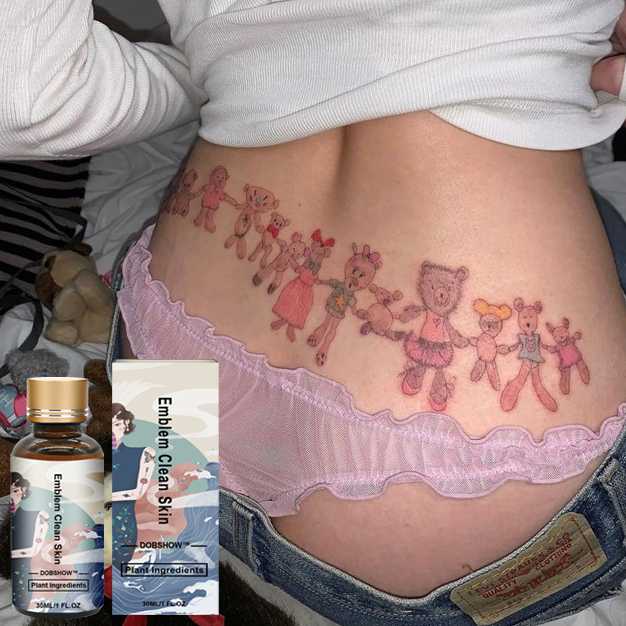 Dobshow™ Tattoo Removal Cream: Quick, Painless, and Scar-Free Tattoo Fading 🌿