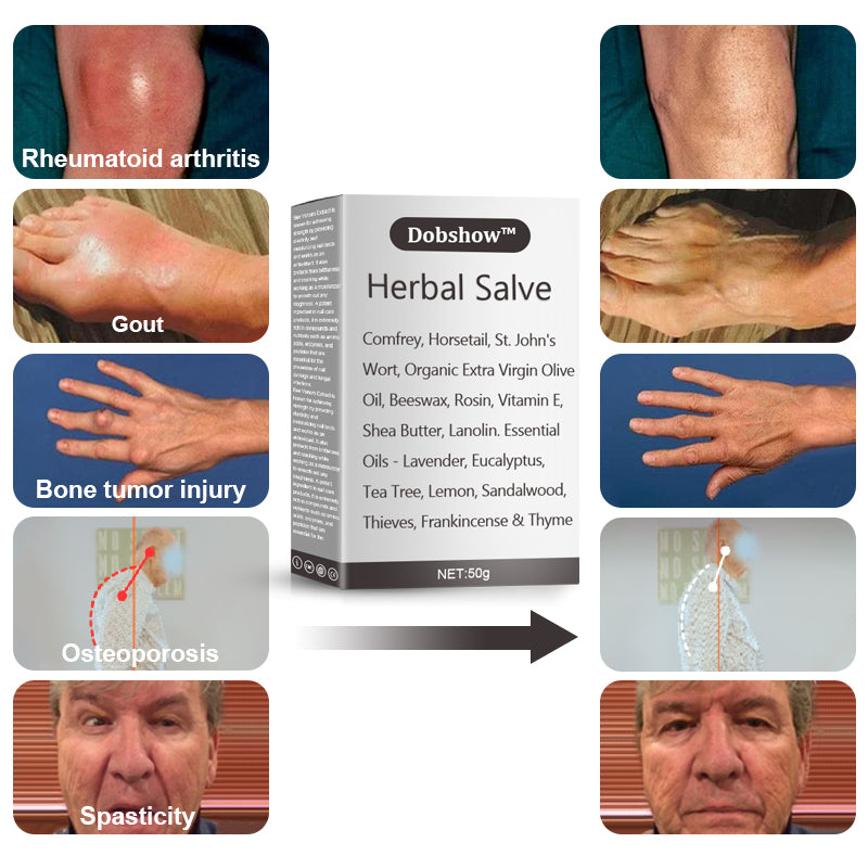 Dobshow™ORGANIC HERBAL SALVE 4OZ