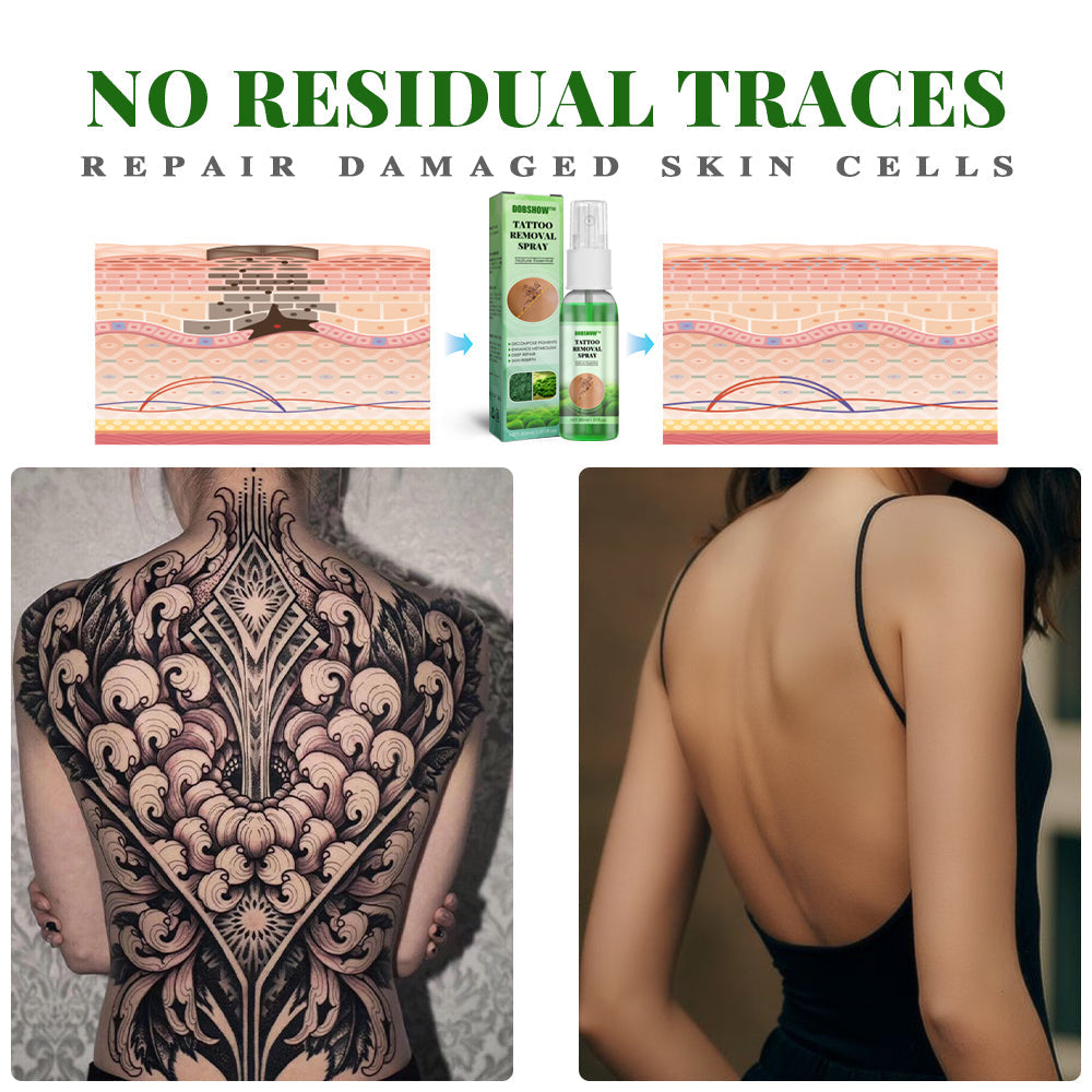 Dobshow™ Tattoo Removal Cream: Fast, Painless & Scar-Free Tattoo Erasure