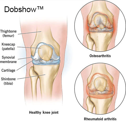 Dobshow™ Bee Venom Joint & Bone Therapy Gel 🐝💪