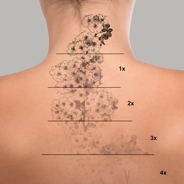 Dobshow™ Tattoo Removal Cream: Fast, Painless & Scar-Free Tattoo Erasure