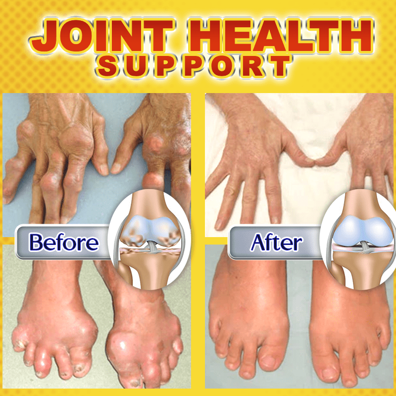 Dobshow™ Bee Venom Joint & Bone Therapy Gel 🐝💪