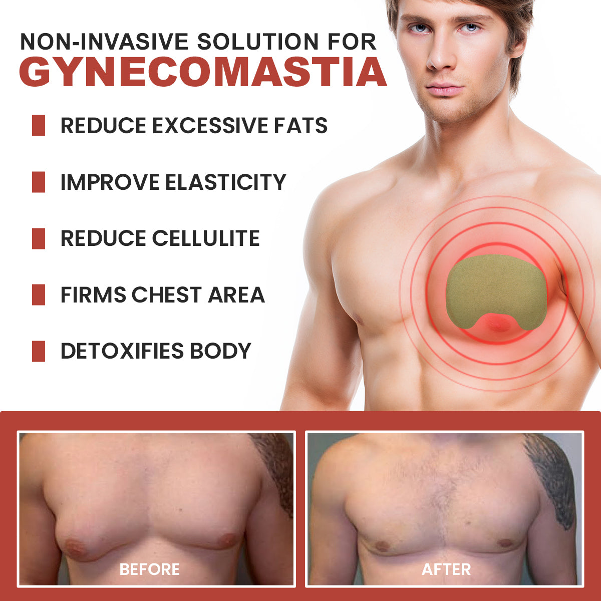 💪🌟 Nurbini™ Gynecomastia & Cellulite Reduction Patches ✨💪