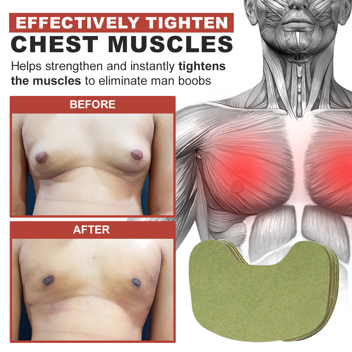 💪🌟 Nurbini™ Gynecomastia & Cellulite Reduction Patches ✨💪