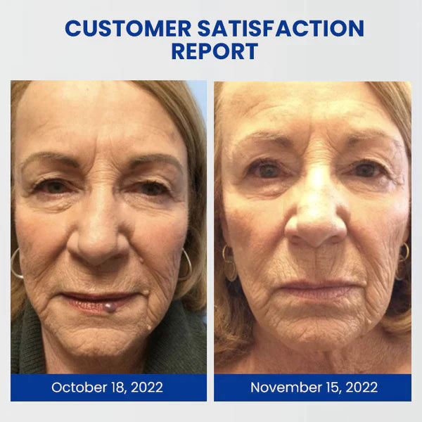 Dobshow™ WartsOff Rapid Cream for Instant Skin Impurity Removal