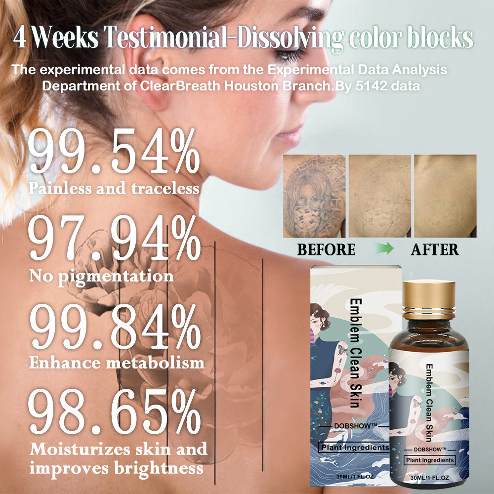 Dobshow™ Tattoo Removal Cream: Quick, Painless, and Scar-Free Tattoo Fading❤️
