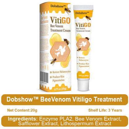 🐝Dobshow™ BeeVenom Vitiligo Treatment Cream