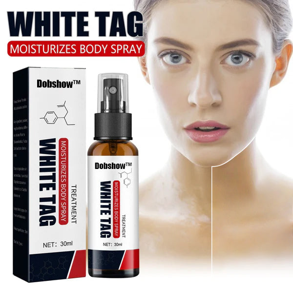 🌿 Herbal Vitiligo Relief Spray 🎉: Nature's Touch for Even Skin Tone ✨