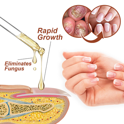 Dobshow™ 7 Days Growth and Strengthening Nail Serum💅🌱💪
