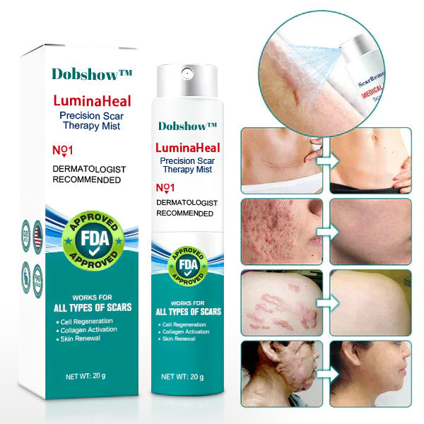 Dobshow™ LuminaHeal Precision Scar Therapy Mist-For All Types of Scars - For example Acne Scars, Surgical Scars and Stretch Marks ⚡️⚡️⚡️