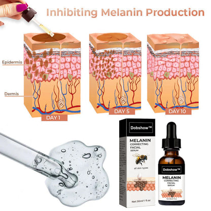 ✨Fast Dark Spot Remover-Dobshow™ Melanin Correcting Facial Serum