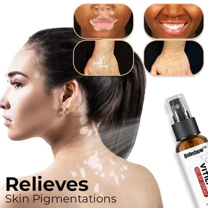 🌿 Herbal Vitiligo Relief Spray 🎉: Nature's Touch for Even Skin Tone ✨