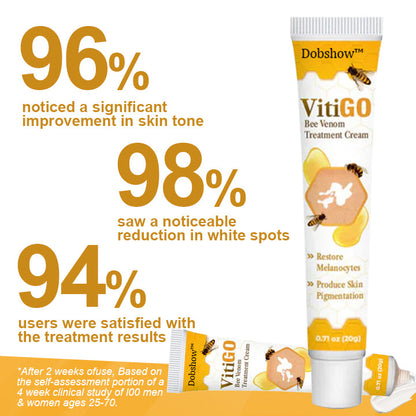 🐝Dobshow™ BeeVenom Vitiligo Treatment Cream