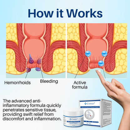 𝐂𝐯𝐫𝐞𝐨𝐳® 𝐇𝐞𝐦𝐨𝐫𝐫𝐡𝐨𝐢𝐝 & 𝐅𝐢𝐬𝐬𝐮𝐫𝐞 𝐂𝐫𝐞𝐚𝐦