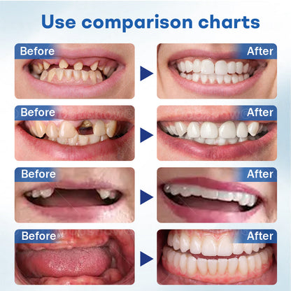 𝐍𝐮𝐫𝐛𝐢𝐧𝐢® 𝐓𝐡𝐞𝐫𝐦𝐨𝐒𝐞𝐚𝐥 𝐅𝐫𝐞𝐬𝐡 𝐃𝐞𝐧𝐭𝐮𝐫𝐞- ✅ Clinically proven to completely solve denture slippage and discomfort
