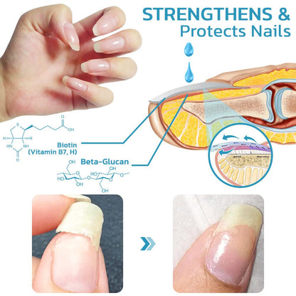 Nurbini™ OnycholysisHeal: Nail Strengthening and Growth Repair Essence 💅✨