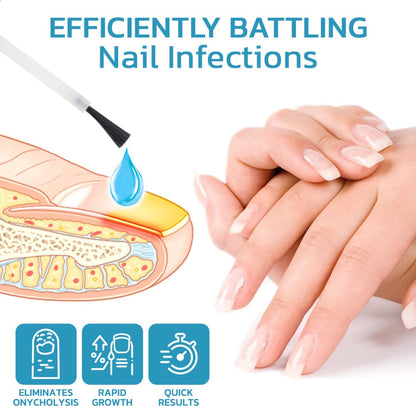 Nurbini™ OnycholysisHeal: Nail Strengthening and Growth Repair Essence 💅✨
