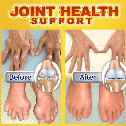 Dobshow™ Bee Venom Joint & Bone Therapy Gel 🐝💪