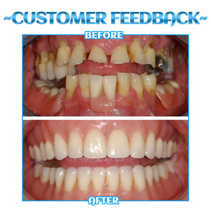 Dobshow™ SmileBright Mousse 🌟✨ Total Oral Care 🦷💧