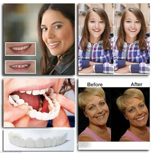 Nurbini™ ProX Adjustable Snap-On Dentures